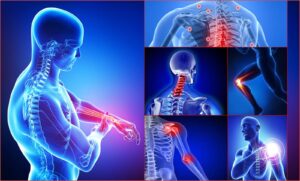 Dolor Osteoarticular